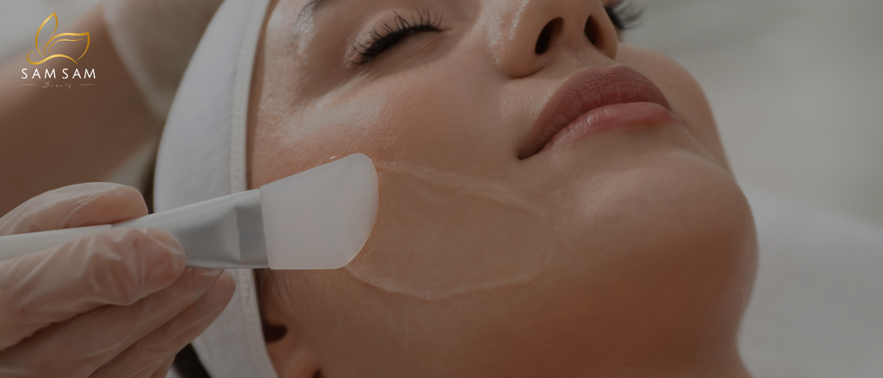 Peel da không bong tróc tại Sam Sam đang được nhiều khách hàng ưa chuộng