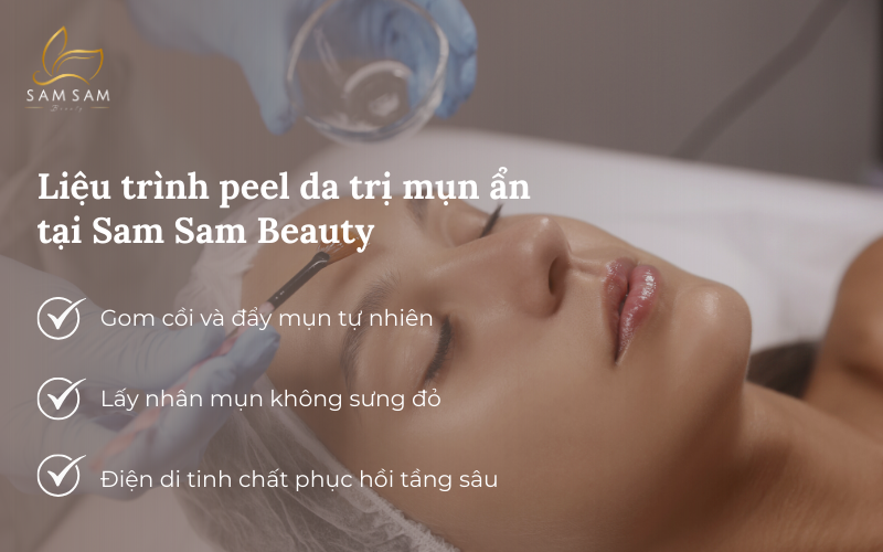 Sam Sam Beauty thiết kế quy trình peel da trị mụn ẩn chuẩn y khoa giúp bạn lấy lại làn da căng bóng mịn màng 