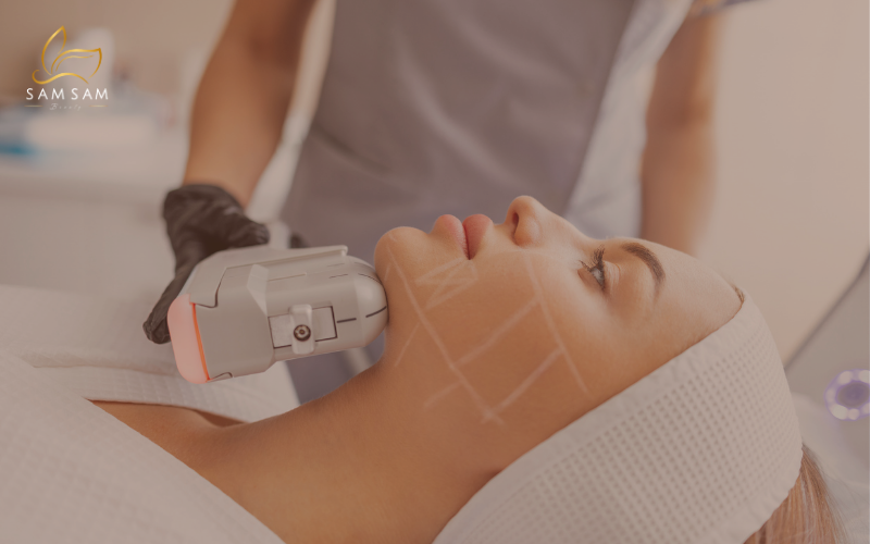 호치민 V라인 리프팅을 위해 하이푸를 선택한 고객의 전후 사진