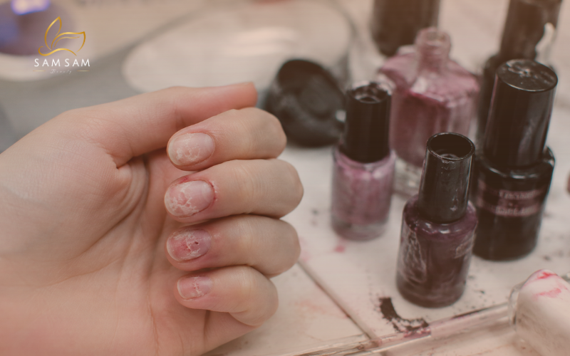 Dấu hiệu tiệm nail kém chất lượng khiến móng yếu và dễ tổn thương